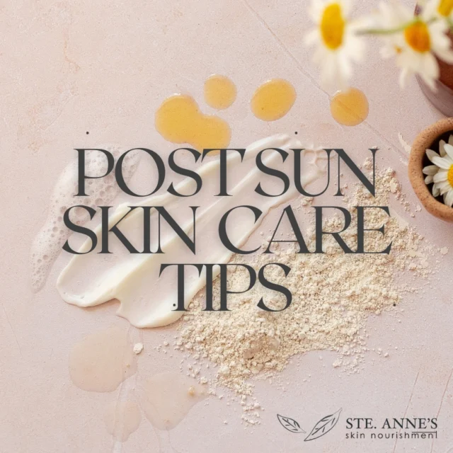 We shared some after-sun skin care tips a couple of weeks ago, and weve made it easy to save into one post! Read on, your skin will thank you!  #aftersuncare #steannesskinnourishment #skinnourishment